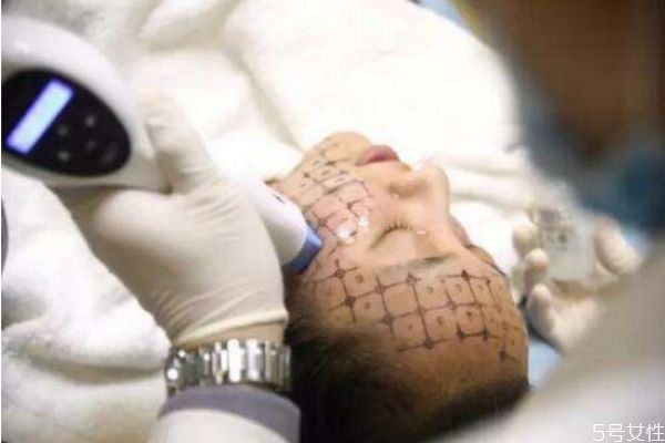 醫(yī)美有哪些常見項目 做醫(yī)美項目要注意什么 醫(yī)美有哪些常見項目 做醫(yī)美項目要注意什么