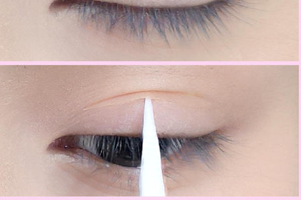 蕾絲雙眼皮貼會讓眼皮松弛嗎 蕾絲雙眼皮貼會導(dǎo)致眼皮松弛嗎 蕾絲雙眼皮貼會讓眼皮松弛嗎 蕾絲雙眼皮貼會導(dǎo)致眼皮松弛嗎