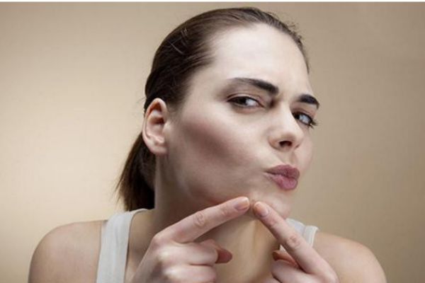 擠痘痘的壞處有什么 為什么不能擠痘痘 擠痘痘的壞處有什么 為什么不能擠痘痘