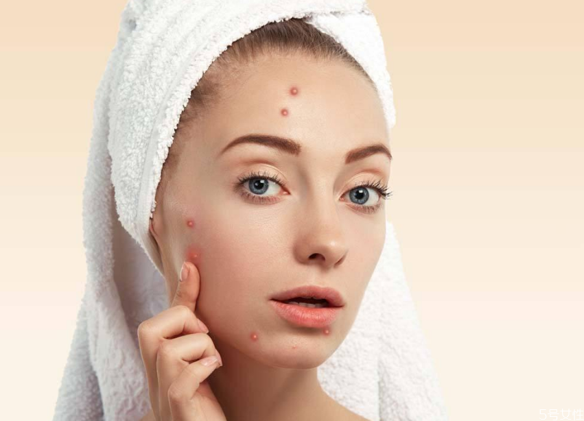 戴口罩下巴長(zhǎng)痘痘怎么辦 怎樣避免戴口罩悶痘 戴口罩下巴長(zhǎng)痘痘怎么辦 怎樣避免戴口罩悶痘