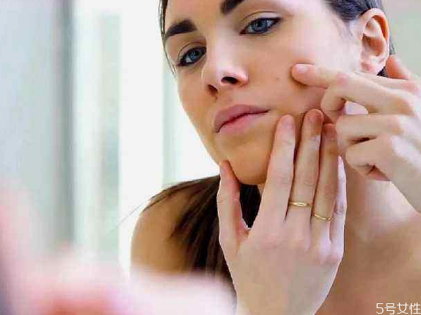 戴口罩長痘痘涂什么藥膏 口罩悶痘怎么快速消除 戴口罩長痘痘涂什么藥膏 口罩悶痘怎么快速消除