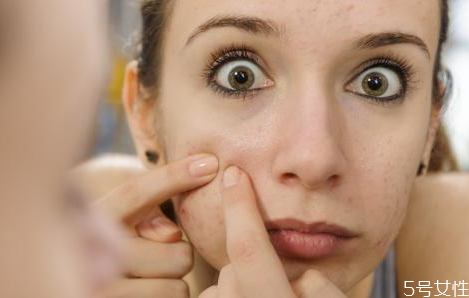 戴口罩會(huì)長(zhǎng)痘痘嗎 長(zhǎng)期戴口罩臉上長(zhǎng)痘痘怎么辦 戴口罩會(huì)長(zhǎng)痘痘嗎 長(zhǎng)期戴口罩臉上長(zhǎng)痘痘怎么辦