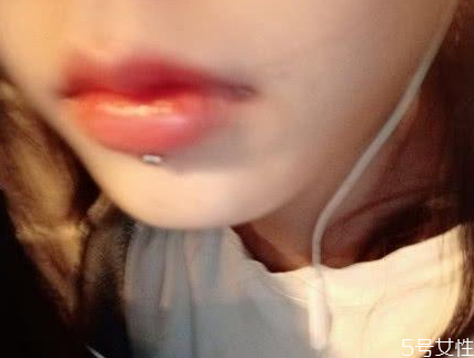 唇釘洞發(fā)臭怎么辦 唇釘怎么護理