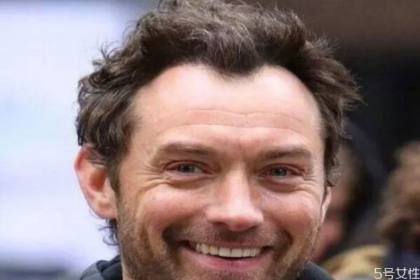 m字型發(fā)際線怎么辦 m型發(fā)際線一定會(huì)禿頂嗎 m字型發(fā)際線怎么辦 m型發(fā)際線一定會(huì)禿頂嗎