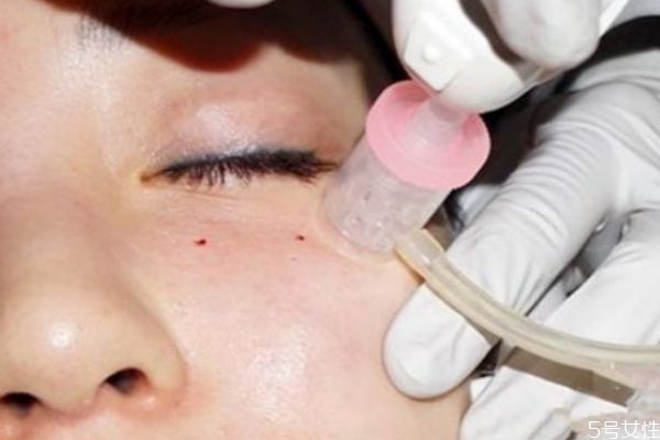 做水光24小時后化妝了可以嗎 水光針品牌都有哪些 做水光24小時后化妝了可以嗎 水光針品牌都有哪些