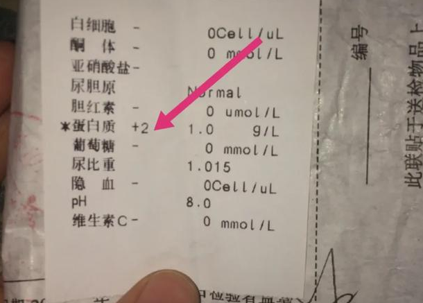 腎不好的人有什么表現(xiàn) 人腎不好身體有什么反應 腎不好的人有什么表現(xiàn) 人腎不好身體有什么反應