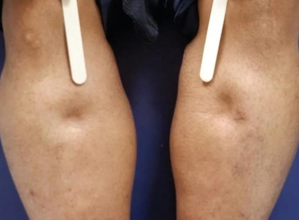 腎不好的人有什么表現(xiàn) 人腎不好身體有什么反應 腎不好的人有什么表現(xiàn) 人腎不好身體有什么反應