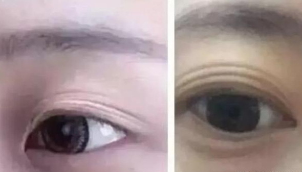 腎不好的人有什么表現(xiàn) 人腎不好身體有什么反應 腎不好的人有什么表現(xiàn) 人腎不好身體有什么反應