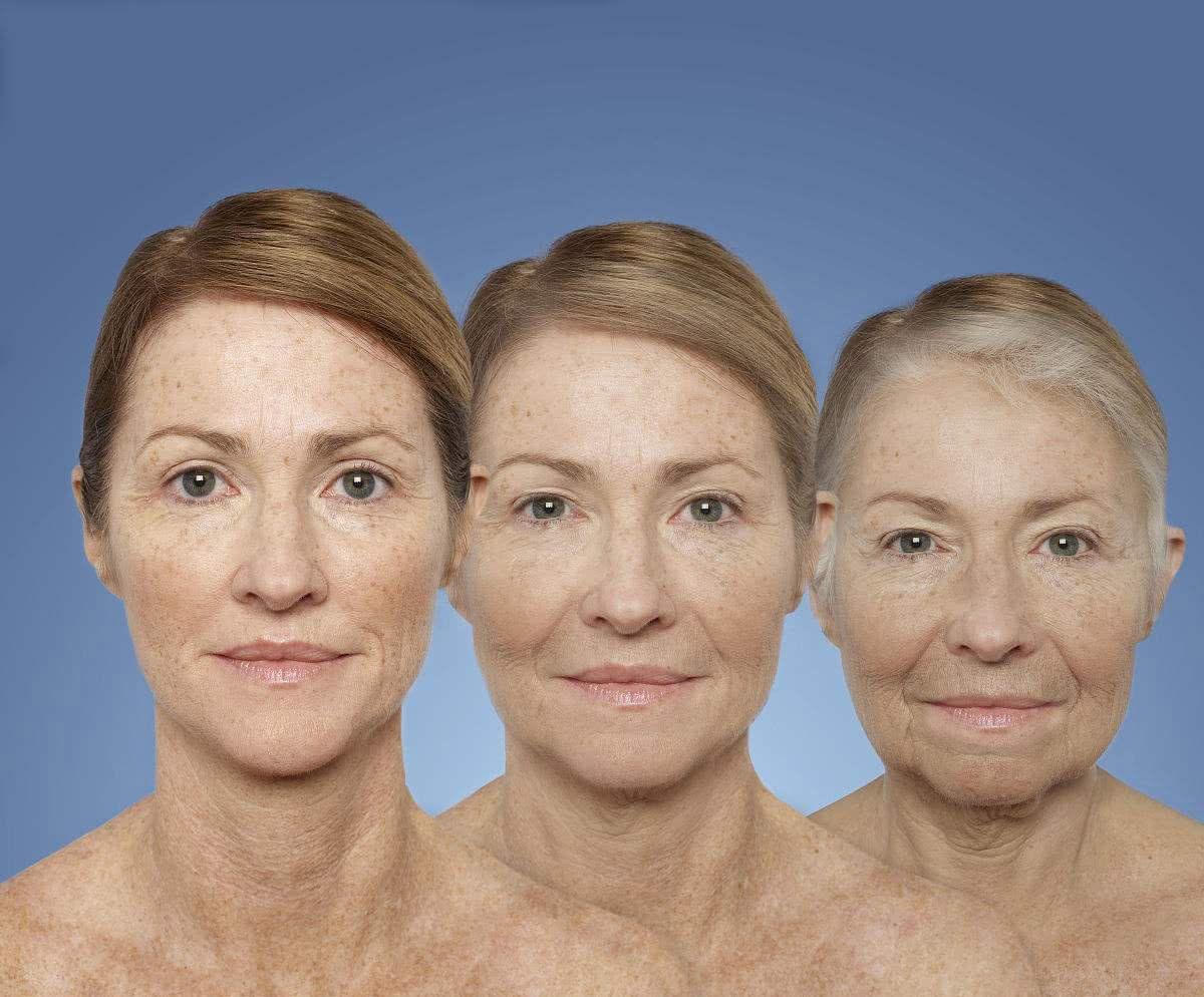 皮膚氧化是什么意思 皮膚氧化了怎么修復 皮膚氧化是什么意思 皮膚氧化了怎么修復