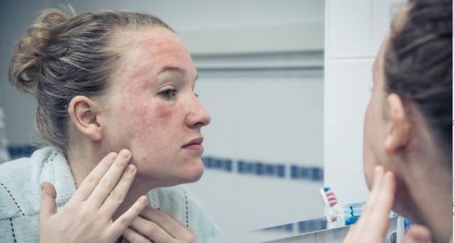 敏感肌臉頰泛紅怎么修復 敏感肌怎么修復成正常肌膚 敏感肌臉頰泛紅怎么修復 敏感肌怎么修復成正常肌膚