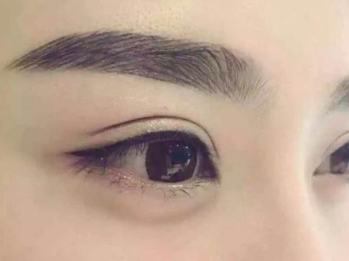 美瞳線可以洗掉嗎 美瞳線幾天恢復(fù)正常 美瞳線可以洗掉嗎 美瞳線幾天恢復(fù)正常