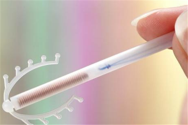 皮埋避孕怎么做 皮埋避孕怎么取 皮埋避孕怎么做 皮埋避孕怎么取