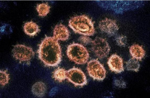 新冠病毒變異最新特征 變異新冠病毒有什么特點(diǎn) 新冠病毒變異最新特征 變異新冠病毒有什么特點(diǎn)