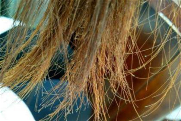 頭發(fā)有分叉怎么辦 頭發(fā)有分叉怎么護理