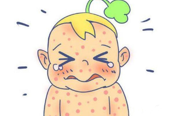 孩子過(guò)敏要去醫(yī)院?jiǎn)?孩子過(guò)敏要吃什么藥 孩子過(guò)敏要去醫(yī)院?jiǎn)?孩子過(guò)敏要吃什么藥
