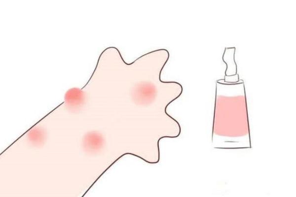 孩子過(guò)敏要去醫(yī)院?jiǎn)?孩子過(guò)敏要吃什么藥 孩子過(guò)敏要去醫(yī)院?jiǎn)?孩子過(guò)敏要吃什么藥