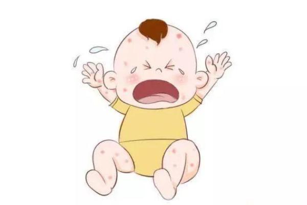 孩子身上起疙瘩很癢怎么回事 孩子過敏起疙瘩怎么辦 孩子身上起疙瘩很癢怎么回事 孩子過敏起疙瘩怎么辦