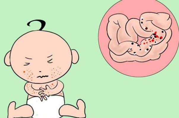 嬰兒過敏嚴重會怎么樣 嬰兒過敏嚴重有自愈可能嗎 嬰兒過敏嚴重會怎么樣 嬰兒過敏嚴重有自愈可能嗎
