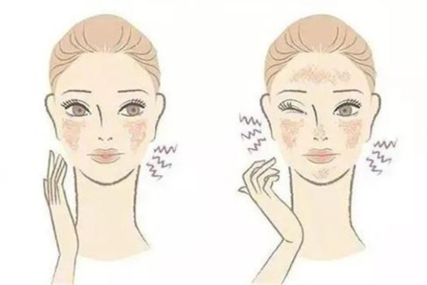 敏感肌怎么造成的 敏感肌要修復(fù)多久才好 敏感肌怎么造成的 敏感肌要修復(fù)多久才好