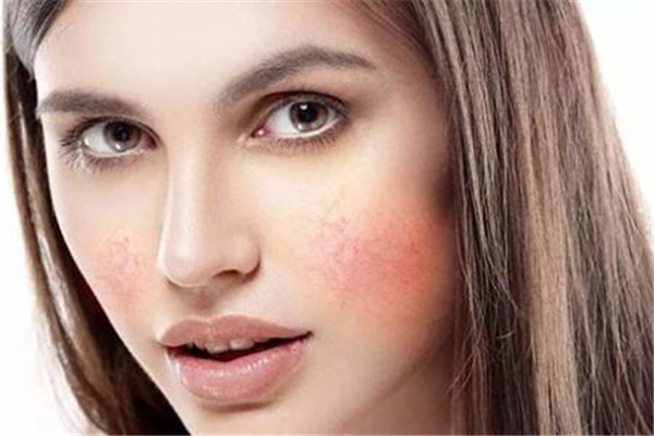 敏感肌臉部發(fā)紅怎么修復(fù) 敏感肌怎么修復(fù)成正常肌膚 敏感肌臉部發(fā)紅怎么修復(fù) 敏感肌怎么修復(fù)成正常肌膚