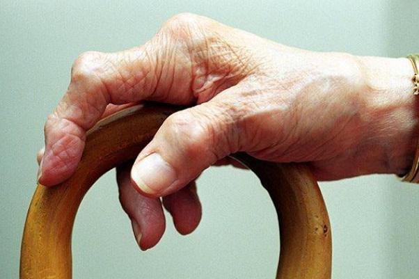 風濕病能徹底治愈嗎 風濕病不能吃的食物 風濕病能徹底治愈嗎 風濕病不能吃的食物