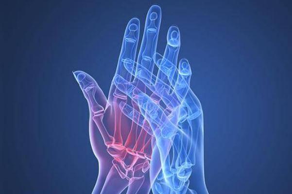 風(fēng)濕病會傳染他人嗎 風(fēng)濕病會發(fā)燒嗎 風(fēng)濕病會傳染他人嗎 風(fēng)濕病會發(fā)燒嗎