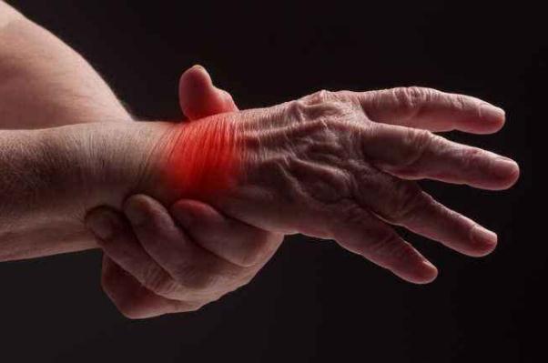 風濕病是痛風嗎 風濕病是炎癥嗎 風濕病是痛風嗎 風濕病是炎癥嗎