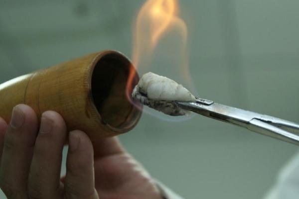 拔火罐的印子多久消除 拔火罐的頻率多久一次