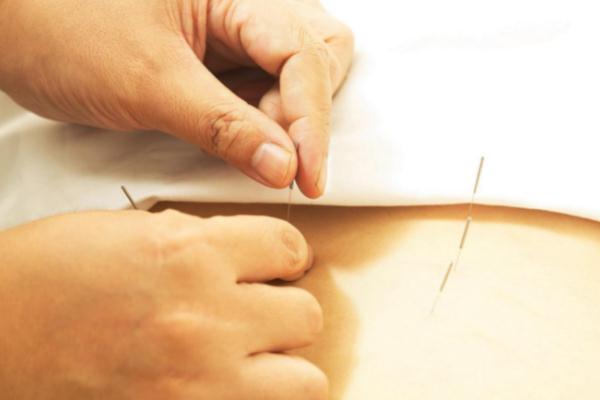 針灸對(duì)神經(jīng)損傷恢復(fù)有作用嗎 針灸對(duì)耳鳴治耳鳴有效果嗎 針灸對(duì)神經(jīng)損傷恢復(fù)有作用嗎 針灸對(duì)耳鳴治耳鳴有效果嗎