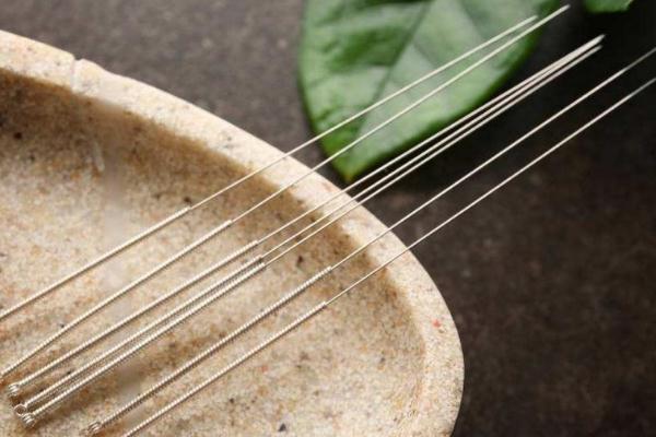 針灸對胃病有效果嗎 針灸對胃病有好處嗎 針灸對胃病有效果嗎 針灸對胃病有好處嗎