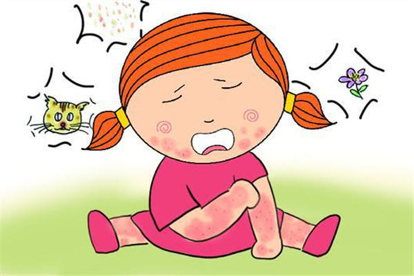 蕁麻疹的過敏源有哪些 蕁麻疹吃什么好 蕁麻疹的過敏源有哪些 蕁麻疹吃什么好