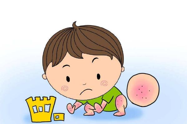 寶寶濕疹的癥狀表現(xiàn) 寶寶濕疹的危害 寶寶濕疹的癥狀表現(xiàn) 寶寶濕疹的危害