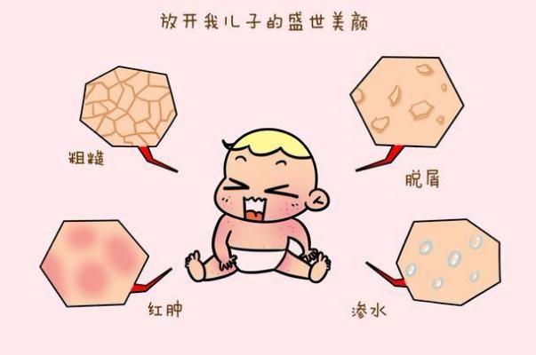 寶寶濕疹反復(fù)是過敏嗎 寶寶濕疹反復(fù)不好怎么辦 寶寶濕疹反復(fù)是過敏嗎 寶寶濕疹反復(fù)不好怎么辦
