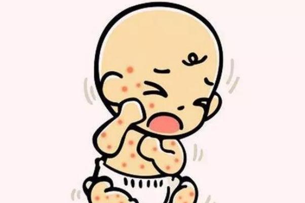 寶寶濕疹會(huì)引起發(fā)燒嗎 寶寶濕疹發(fā)燒怎么辦