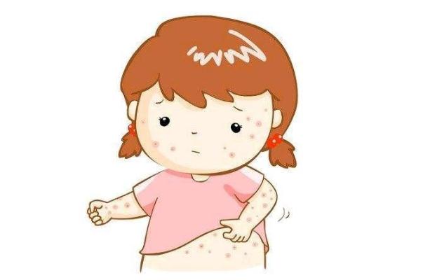 寶寶濕疹是不是熱出來(lái)的 寶寶濕疹是不是很癢