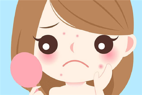 上火會長痘痘嗎 上火長痘痘怎么調(diào)理 上火會長痘痘嗎 上火長痘痘怎么調(diào)理
