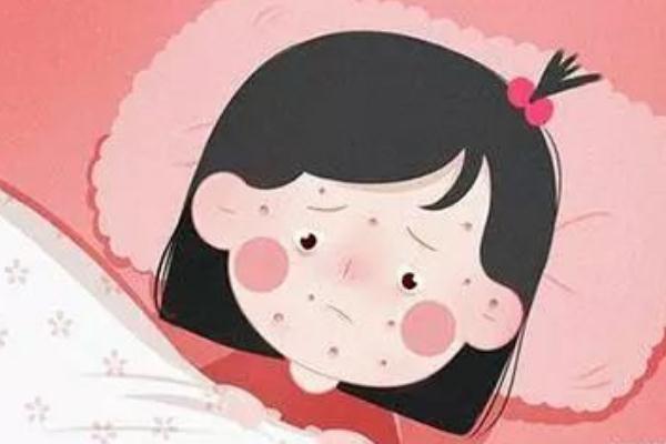 水痘有疫苗嗎 水痘有生命危險嗎 水痘有疫苗嗎 水痘有生命危險嗎