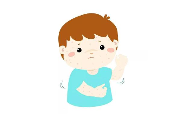 水痘會(huì)傳染給大人嗎 水痘會(huì)傳染給嬰兒?jiǎn)? alt=