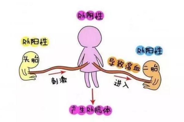 新生兒溶血性疾病 新生兒溶血是什么意思 新生兒溶血性疾病 新生兒溶血是什么意思