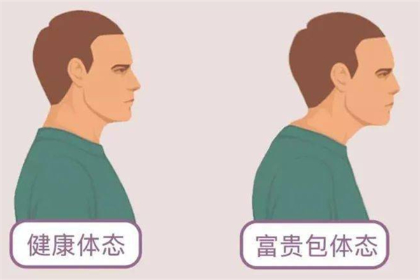 富貴包會引起頭痛嗎 富貴包會引起哪些癥狀