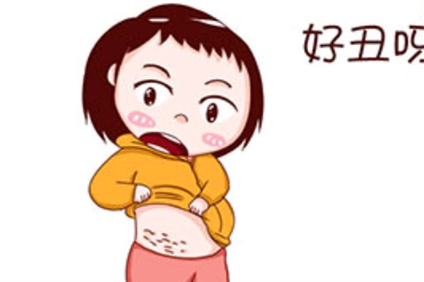 肥胖紋瘦下來可以消除嗎 肥胖紋怎去掉 肥胖紋瘦下來可以消除嗎 肥胖紋怎去掉