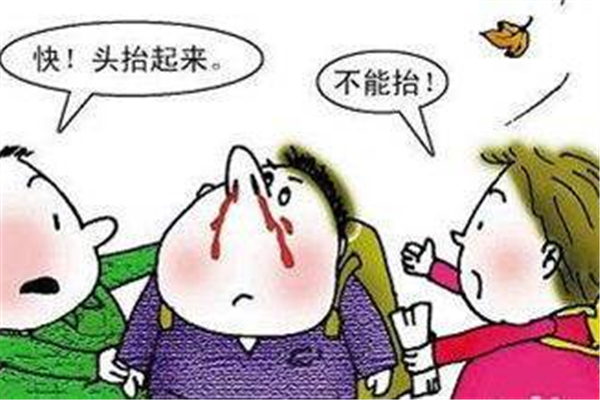 流鼻血要抬頭還是低頭 流鼻血仰頭的危險性 流鼻血要抬頭還是低頭 流鼻血仰頭的危險性