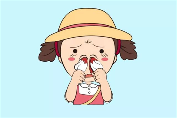 流鼻血是什么原因引起的呢 流鼻血的正確止血辦法 流鼻血是什么原因引起的呢 流鼻血的正確止血辦法