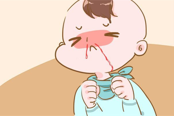 流鼻血要抬頭還是低頭 流鼻血仰頭的危險性 流鼻血要抬頭還是低頭 流鼻血仰頭的危險性