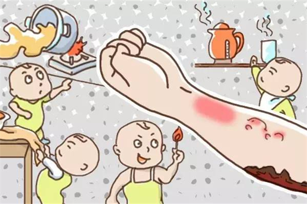 燙傷后紅色疤痕多久恢復(fù)正常 燙傷后為什么會(huì)紅腫 燙傷后紅色疤痕多久恢復(fù)正常 燙傷后為什么會(huì)紅腫