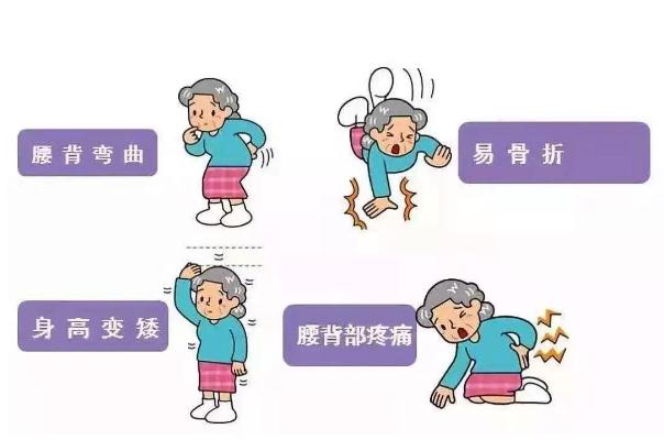 骨質(zhì)疏松有哪些癥狀表現(xiàn) 骨質(zhì)疏松怎么治才能徹底治好