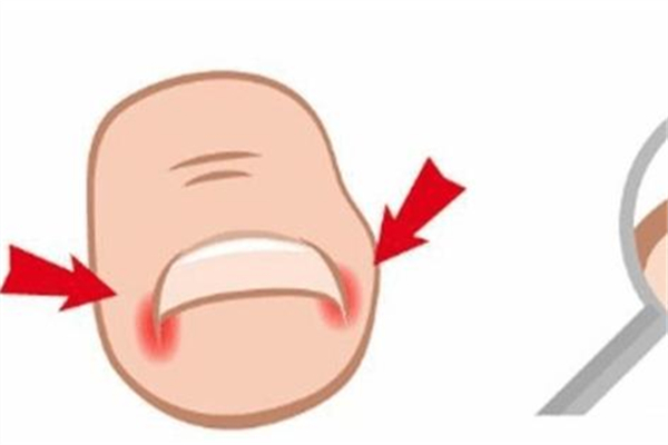 甲溝炎會(huì)自己好嗎 甲溝炎擦碘伏能好嗎 甲溝炎會(huì)自己好嗎 甲溝炎擦碘伏能好嗎