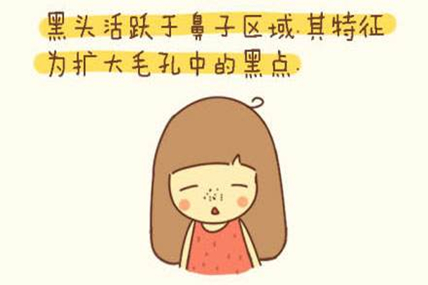 去完黑頭后用什么收縮毛孔 黑頭去完后要用什么東西護(hù)理 去完黑頭后用什么收縮毛孔 黑頭去完后要用什么東西護(hù)理