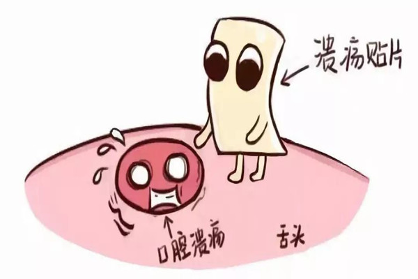 口腔潰瘍會(huì)引起口臭嗎 口腔潰瘍會(huì)引起口腔癌嗎 口腔潰瘍會(huì)引起口臭嗎 口腔潰瘍會(huì)引起口腔癌嗎