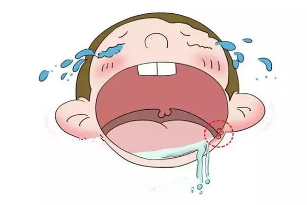 口腔潰瘍?cè)趺粗斡?口腔潰瘍?cè)趺淳徑馓弁? alt=